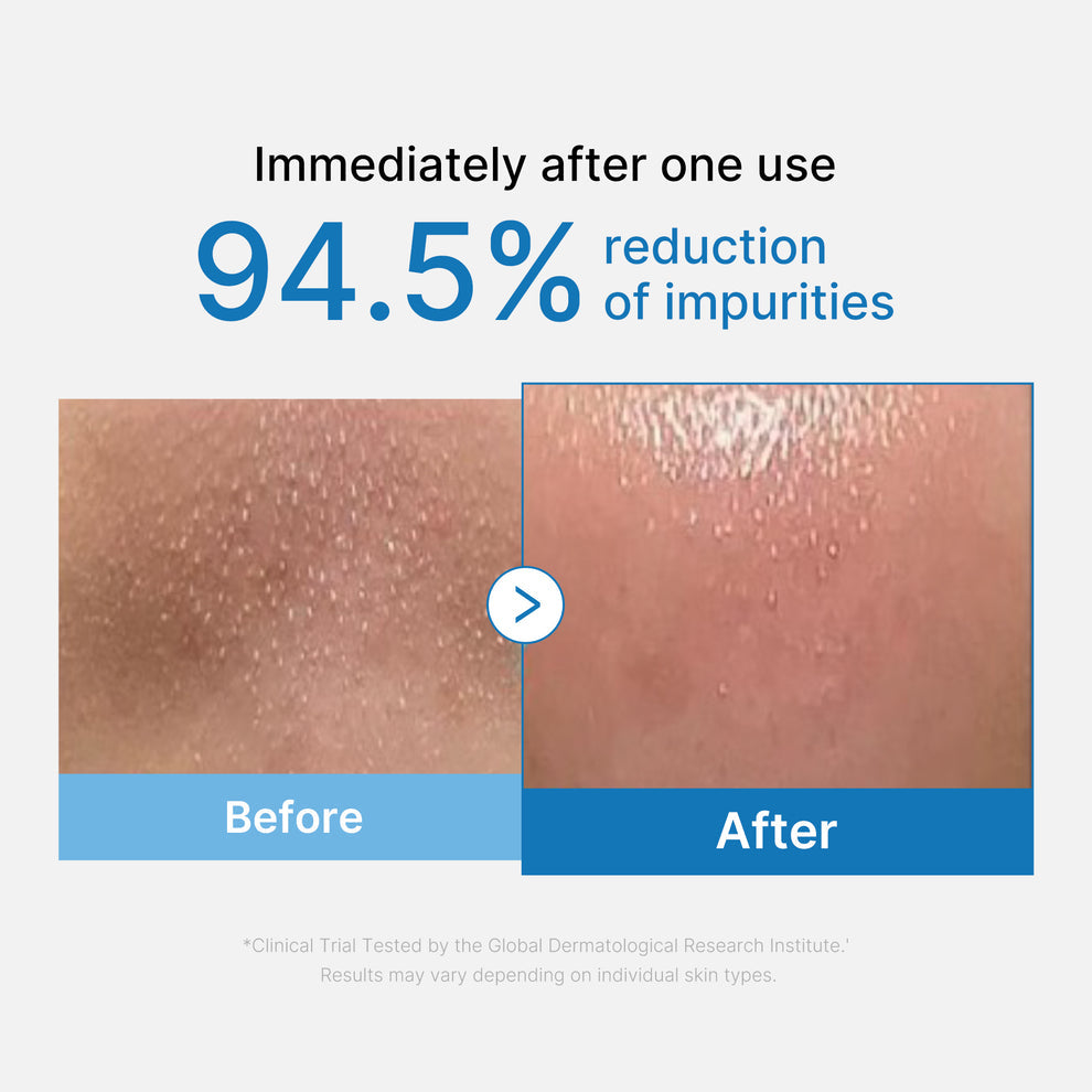 Zero Pore Blackhead Deep Cleansing Oil - Medicube