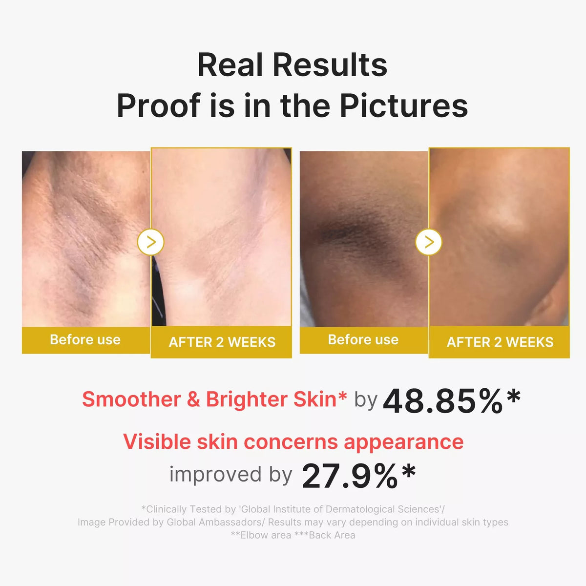 medicube - Kojic Acid Turmeric Body Peel Shot