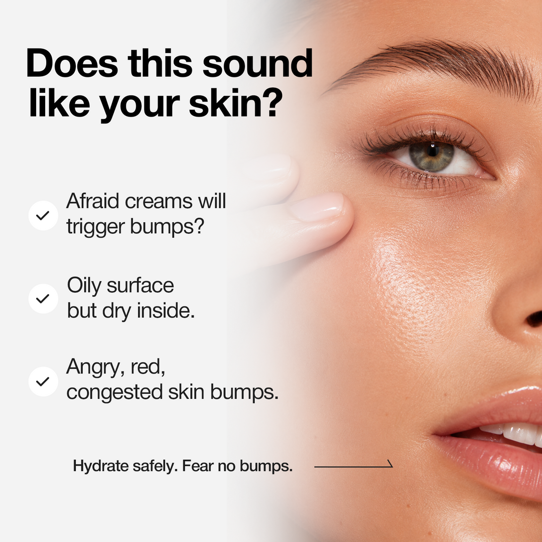 A-Control Azelaic Acid Cream