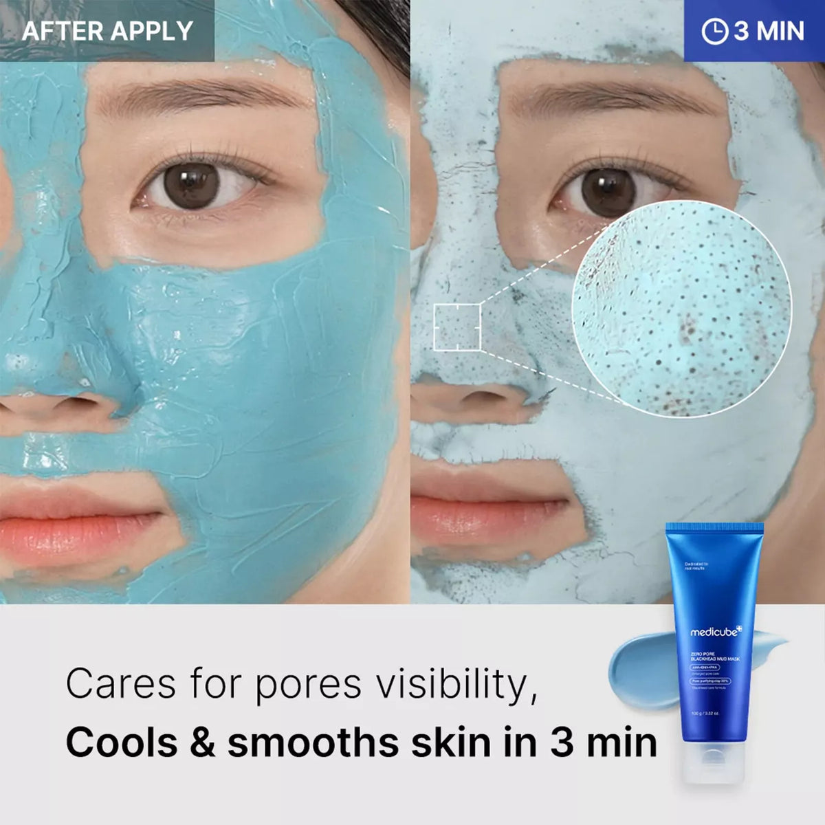medicube - Zero Pore Blackhead Mud Mask