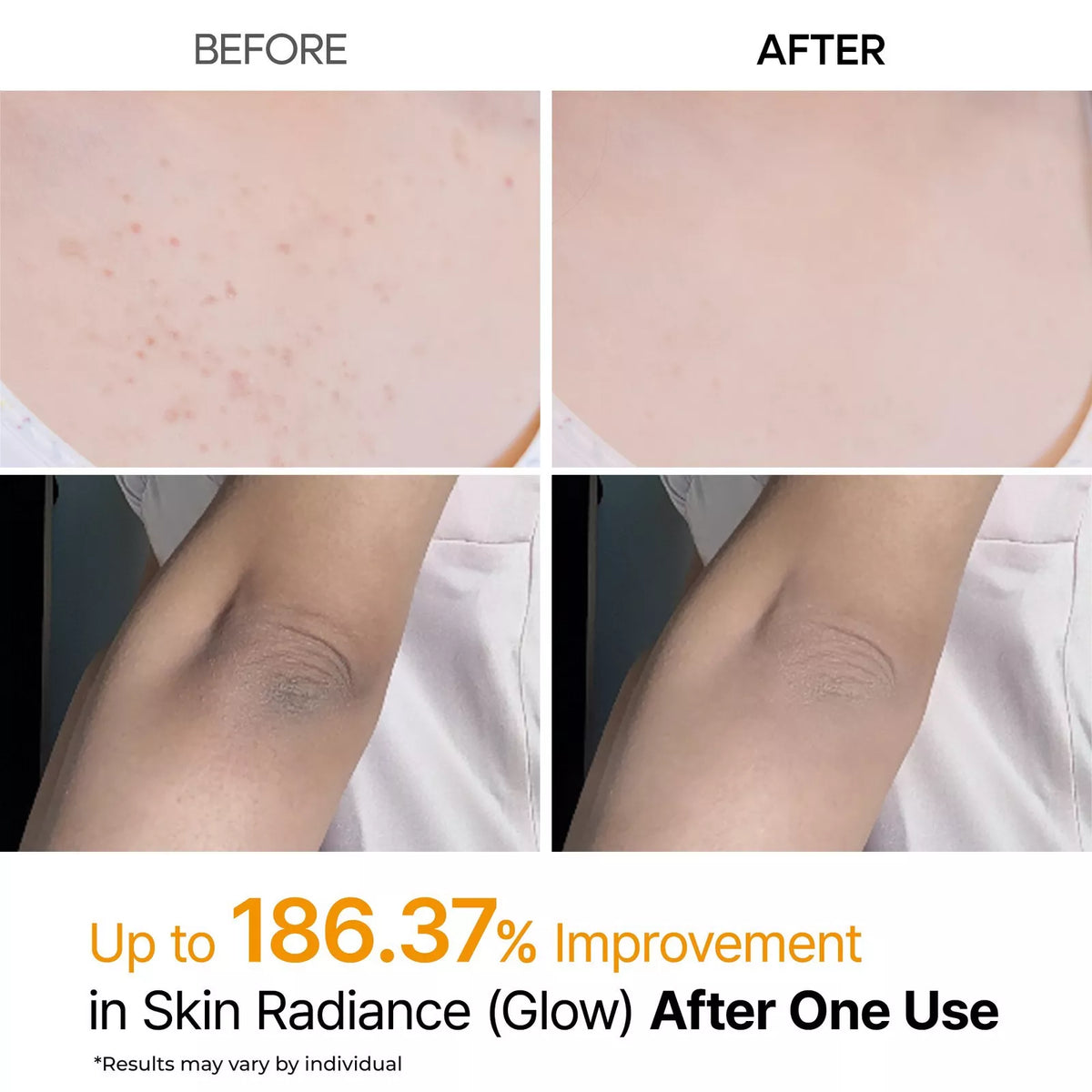 Dr. Melaxin - Peel Shot Exfoliating Kojic Acid Turmeric Spray
